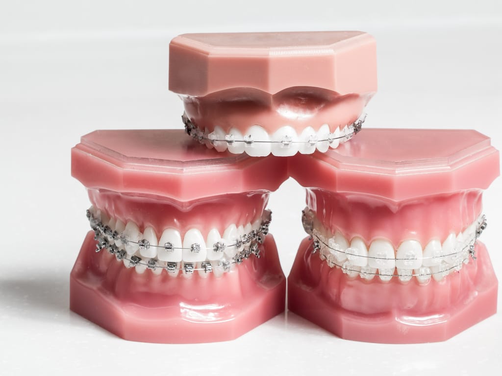 orthodontie dentiste maarif casablanca